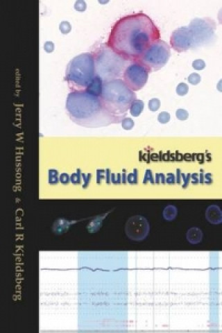 Carte Kjeldsberg's Body Fluid Analysis 