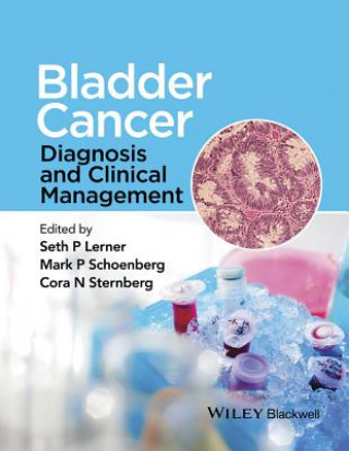 Книга Bladder Cancer - Diagnosis and Clinical Management Seth P. Lerner