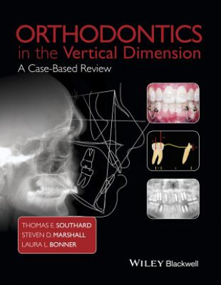 Kniha Orthodontics in the Vertical Dimension - A Case-Based Review Laura L. Bonner