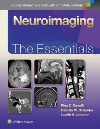 Carte Neuroimaging: The Essentials Pina Sanelli