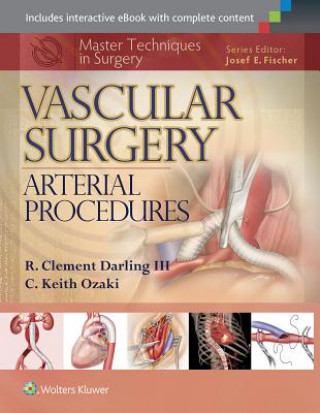Kniha Master Techniques in Surgery: Vascular Surgery: Arterial Procedures R. Clement Darling