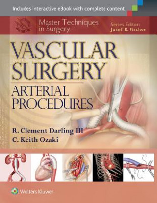 Βιβλίο Master Techniques in Surgery: Vascular Surgery: Arterial Procedures R. Clement Darling