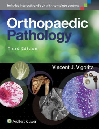 Knjiga Orthopaedic Pathology Vincent J. Vigorita