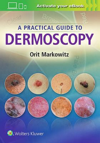 Carte Practical Guide to Dermoscopy Orit Markowitz