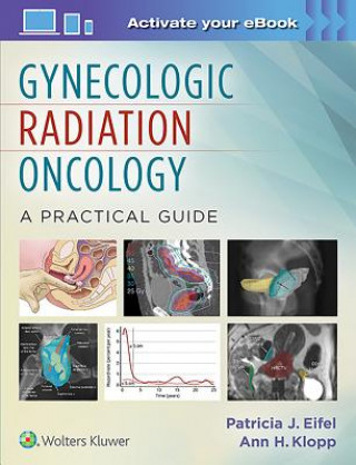 Книга Gynecologic Radiation Oncology: A Practical Guide Patricia Eifel