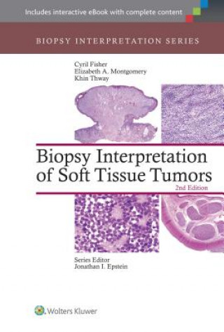 Kniha Biopsy Interpretation of Soft Tissue Tumors Cyril Fisher