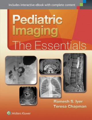 Könyv Pediatric Imaging:The Essentials Ramesh Iyer