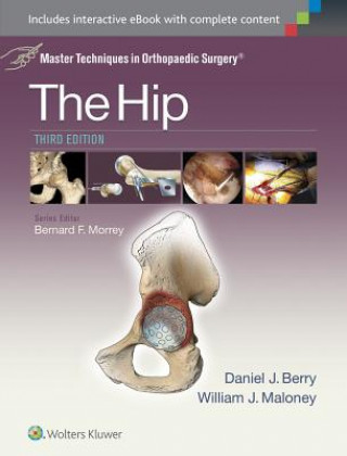 Kniha Master Techniques in Orthopaedic Surgery: The Hip Daniel J. Berry