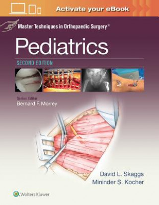 Buch Master Techniques in Orthopaedic Surgery: Pediatrics David L. Skaggs