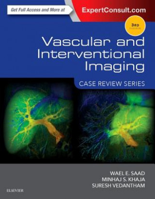 Carte Vascular and Interventional Imaging: Case Review Series Wael Saad