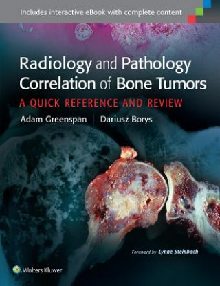 Kniha Radiology and Pathology Correlation of Bone Tumors Adam Greenspan