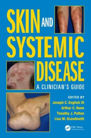 Könyv Skin and Systemic Disease Lisa M. Grandinetti