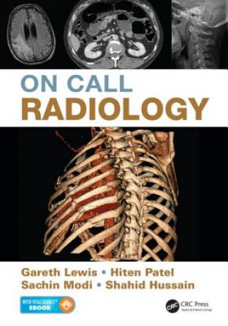 Kniha On Call Radiology Shahid Hussain