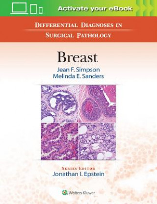 Книга Differential Diagnoses in Surgical Pathology: Breast Jean Simpson