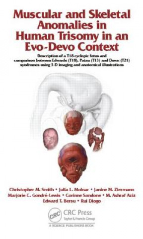 Könyv Muscular and Skeletal Anomalies in Human Trisomy in an Evo-Devo Context Edward T. Bersu