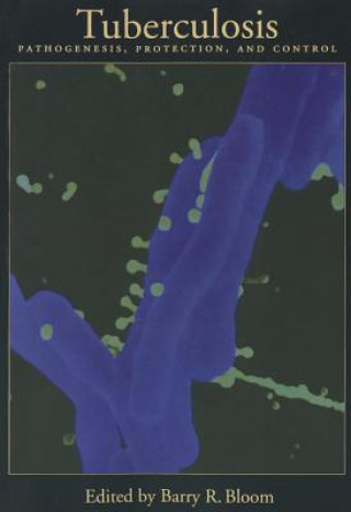 Buch Tuberculosis 