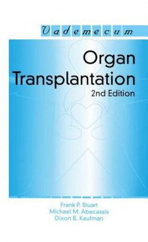 Kniha Organ Transplantation Frank P. Stuart