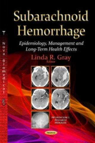 Book Subarachnoid Hemorrhage 