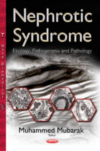 Knjiga Nephrotic Syndrome Muhammed Mubarak
