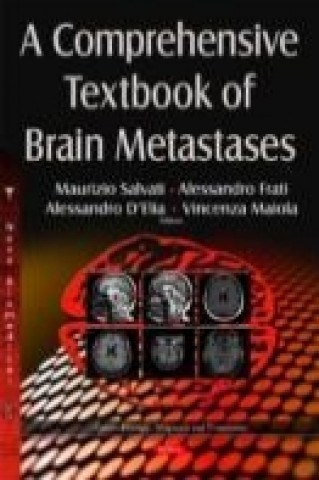 Kniha Comprehensive Textbook of Brain Metastases 