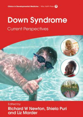 Книга Down Syndrome - Current Perspectives Shiela C. Puri
