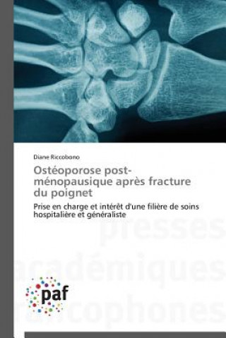 Kniha Osteoporose Post-Menopausique Apres Fracture Du Poignet Riccobono Diane