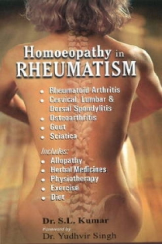 Könyv Homeopathy in Rheumatism S.L. Kumar