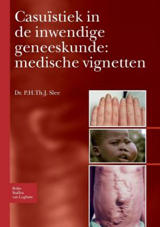 Carte Casuistiek in de Inwendige Geneeskunde: Medische Vignetten P H Th J Slee