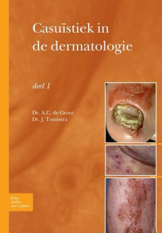 Kniha Casuistiek in de Dermatologie - Deel I Johan Toonstra