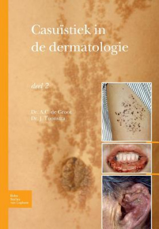 Könyv Casuistiek in de Dermatologie - Deel 2 TOONSTRA  JOHAN