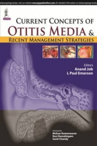 Buch Current Concepts of Otitis Media and Recent Management Strategies Paul L. Emerson