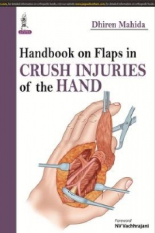 Kniha Handbook on Flaps in Crush Injuries of the Hand Dhiren Mahida