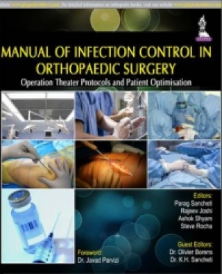 Book Manual of Infection Control in Orthopaedic Surgery Ashok Shyam