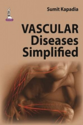Könyv Vascular Diseases Simplified Sumit Kapadia