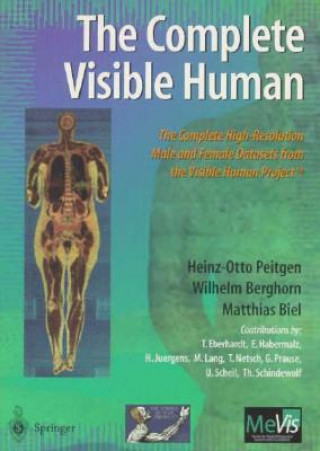 Digital Complete Visible Human T. Eberhardt