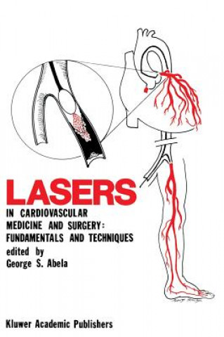Kniha Lasers in Cardiovascular Medicine and Surgery: Fundamentals and Techniques George S. Abela