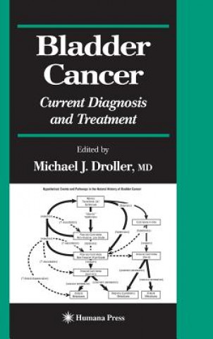 Carte Bladder Cancer Michael J. Droller