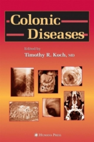 Livre Colonic Diseases Timothy R. Koch