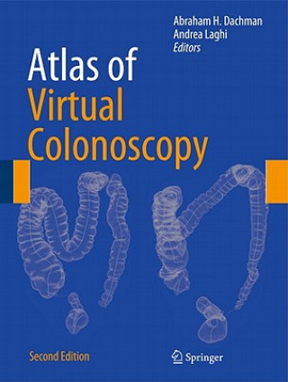 Carte Atlas of Virtual Colonoscopy Abraham H. Dachman