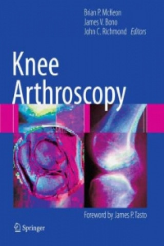 Kniha Knee Arthroscopy Brian McKeon
