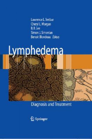 Buch Lymphedema Lawrence L Tretbar