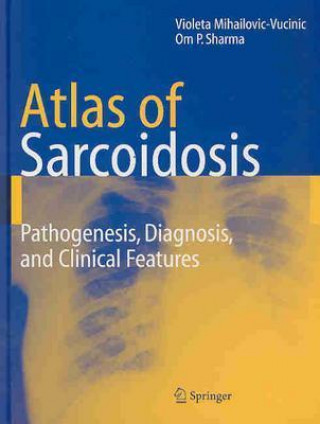 Книга Atlas of Sarcoidosis Violeta Mihailovic-Vucinic