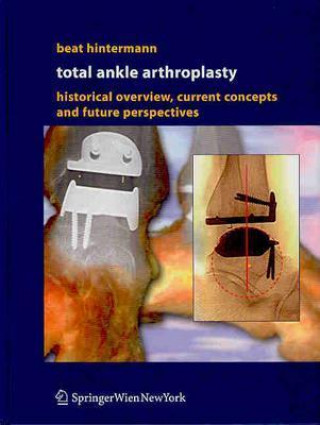 Könyv Total Ankle Arthroplasty Beat Hintermann