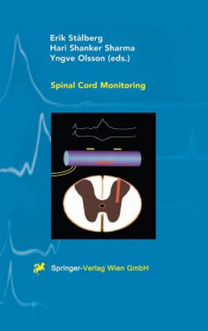 Carte Spinal Cord Monitoring Eric Stalberg