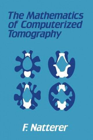 Carte The Mathematics of Computerized Tomography F. Natterer