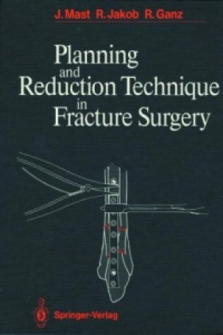 Książka Planning and Reduction Technique in Fracture Surgery H. Willenegger
