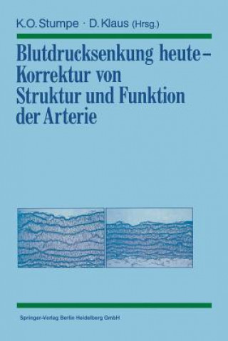 Kniha Blutdrucksenkung Heute -- Korrektur Von Struktur Und Funktion Der Arterie Klaus O. Stumpe