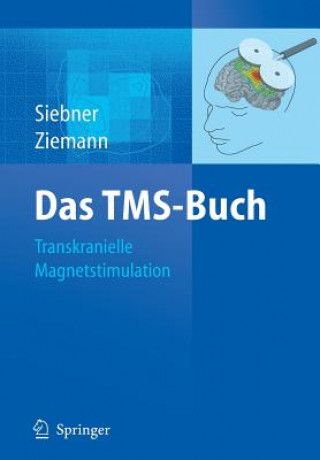 Könyv Das Tms-Buch Hartwig Roman Siebner
