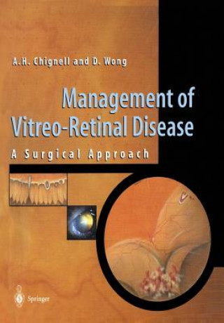 Kniha Management of Vitreo-Retinal Disease Anthony Chignell