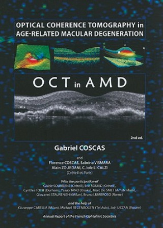 Kniha Optical Coherence Tomography in Age-Related Macular Degeneration Gabriel Coscas